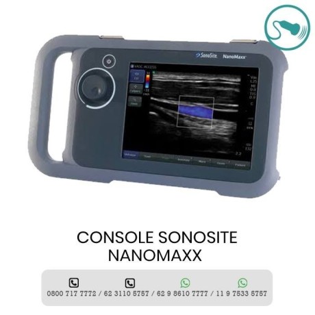 assistencia-tecnica-sonosite-brasil-big-1